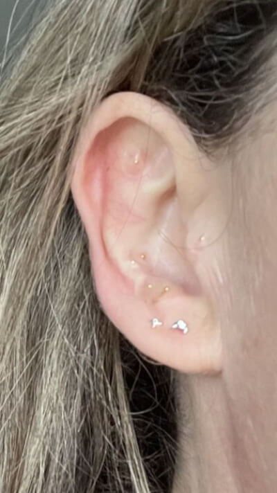 customer_picture